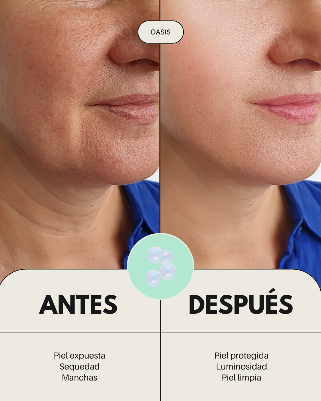 Pack facial básico para piel seca de BANBU, muestra antes y después de la rutina de cuidado facial ecológica y natural.