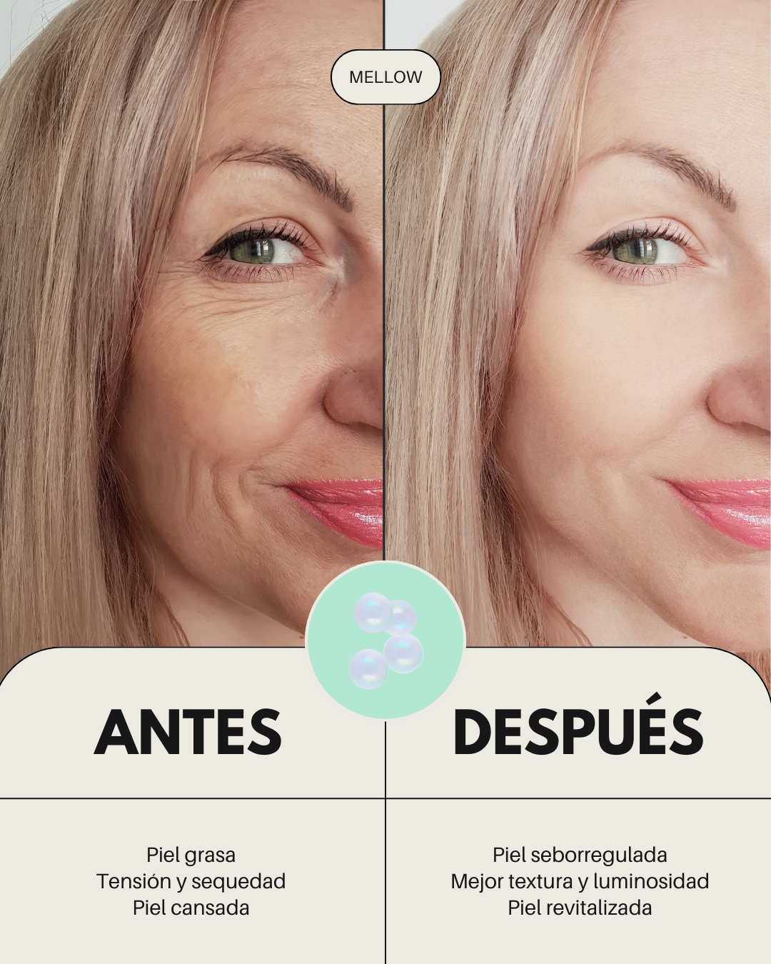 Pack facial BANBU para piel acneica, muestra antes y después del tratamiento para mejorar la apariencia de la piel.