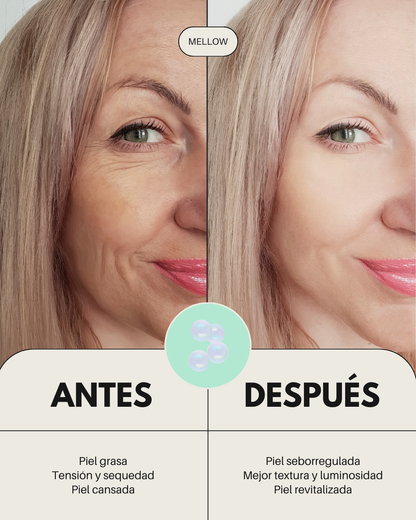 Pack facial BANBU para piel acneica, muestra antes y después del tratamiento para mejorar la apariencia de la piel.