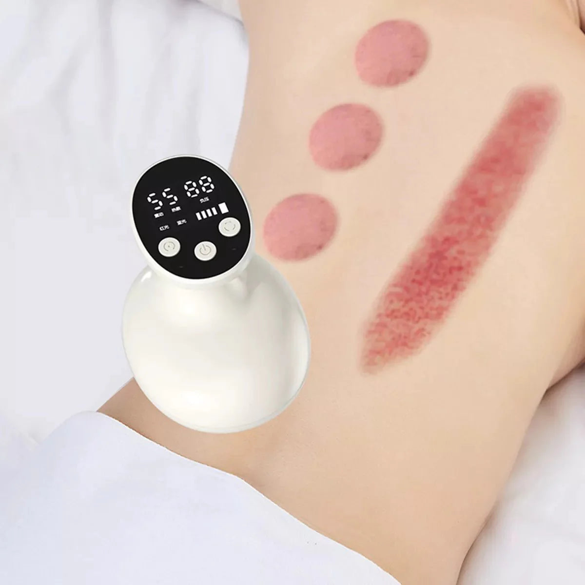 Masajeador anticelulítico recargable innovagizmo con succión, calor y diseño ergonómico para remodelar el cuerpo.