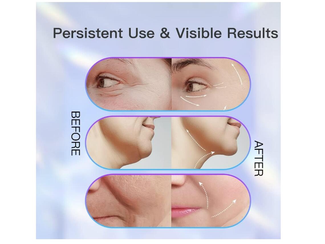 Masajeador facial lifting EMS de innovagizmo.com mostrando placas de masaje y diseño ergonómico para rejuvenecimiento facial.